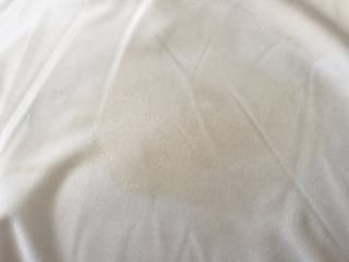 Traces de sébum sur une taie d'oreiller blanche